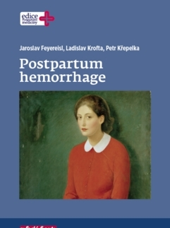 Gynekológia a pôrodníctvo Postpartum hemorrhage - Jaroslav Feyereisl,Ladislav,Petr Křepelka