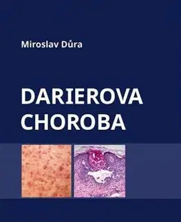 Medicína - ostatné Darierova choroba - Miroslav Důra