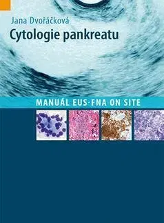 Medicína - ostatné Cytologie pankreatu - Jana Dvořáčková