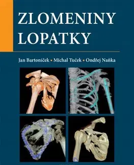 Chirurgia, ortopédia, traumatológia Zlomeniny lopatky - Jan Bartoníček,Michal Tuček,Ondřej Naňka