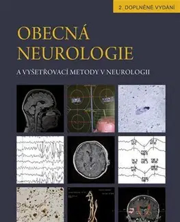 Medicína - ostatné Obecná neurologie a vyšetřovací metody v neurologii - Andrea Bártková,Kolektív autorov,Petr Kaňovský