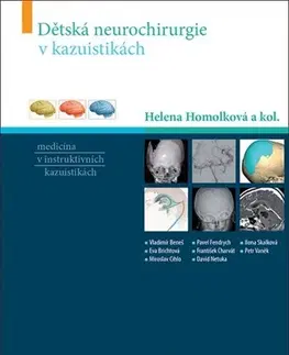 Medicína - ostatné Dětská neurochirurgie v kazuistikách - Helena Homolková,Kolektív autorov
