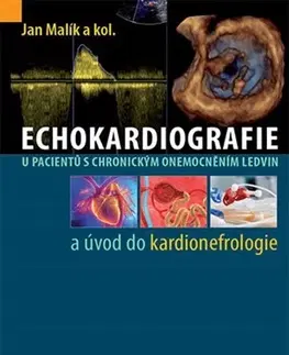 Medicína - ostatné Echokardiografie u pacientů s chronickým onemocněním ledvin a úvod do kardionefrologie - Kolektív autorov,Jan Malík