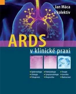 Medicína - ostatné ARDS v klinické praxi - Kolektív autorov