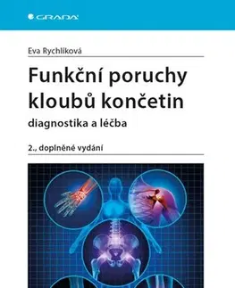Medicína - ostatné Funkční poruchy kloubů končetin - diagnostika a léčba, 2. vydání - Eva Rychlíková