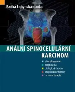 Onkológia Anální spinocelulární karcinom - Radka Lohynská