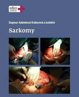 Onkológia Sarkomy - Dagmar Adámková Krákorová,Kolektív autorov