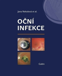 Medicína - ostatné Oční infekce - Jana Nekolová