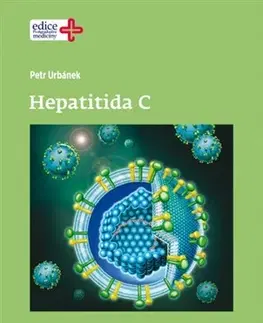 Medicína - ostatné Hepatitida C - Petr Urbánek