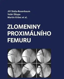 Medicína - ostatné Zlomeniny proximálního femuru - Kolektív autorov