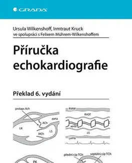 Medicína - ostatné Příručka echokardiografie - Ursula Wilkenshoff