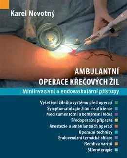 Medicína - ostatné Ambulantní operace křečových žil - Karel Novotný