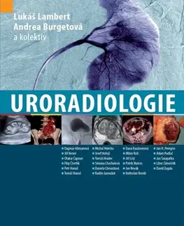 Medicína - ostatné Uroradiologie - Kolektív autorov