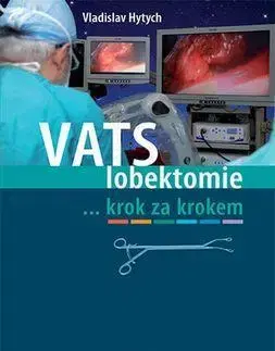 Medicína - ostatné VATS lobektomie - Vladislav Hytych,Jaroslav Nachtigall