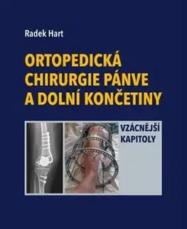 Chirurgia, ortopédia, traumatológia Ortopedická chirurgie pánve a dolní končetiny - Radek Hart