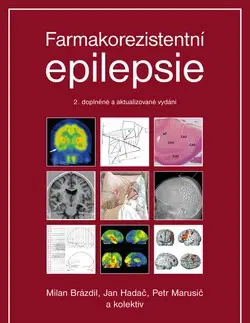 Medicína - ostatné Farmakorezistentní epilepsie - Jan Hadač,Petr Marusič,Milan Brázdil