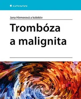 Onkológia Trombóza a malignita - Jana Hirmerová,Kolektív autorov
