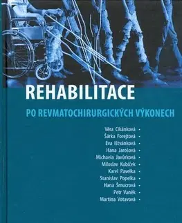Zdravie, životný štýl - ostatné Rehabilitace po reumatochirurgických výkonech - Cikánková