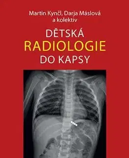 Medicína - ostatné Dětská radiologie do kapsy - Kolektív autorov