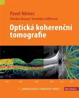 Medicína - ostatné Optická koherenční tomografie - Pavel Němec,Bohdan Kousal,Veronika Löfflerová