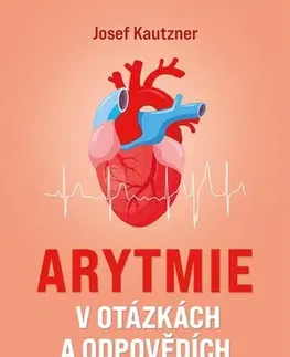 Medicína - ostatné Arytmie v otázkách a odpovědích - Josef Kautzner