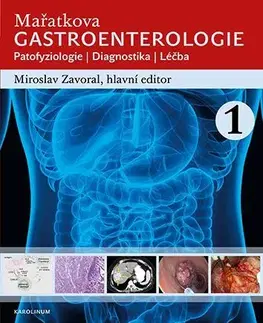 Medicína - ostatné Mařatkova gastroenterologie - Miroslav Zavoral