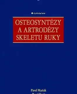 Medicína - ostatné Osteosyntézy a artrodézy skeletu ruky - Pavel Maňák,Pavel Dráč