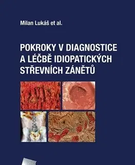 Medicína - ostatné Pokroky v diagnostice a léčbě idiopatických střevních zánětů - Kolektív autorov,Milan Lukáš