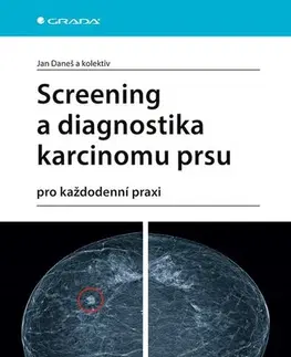 Onkológia Screening a diagnostika karcinomu prsu - Jan Daneš,Kolektív autorov