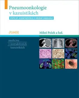 Medicína - ostatné Pneumoonkologie v kazuistikách - Kolektív autorov,Miloš Pešek