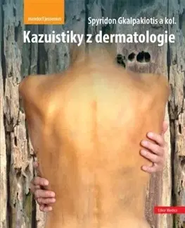 Medicína - ostatné Kazuistiky z dermatologie - Kolektív autorov,Spyridon Gkalpakiotis