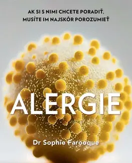 Zdravoveda, ochorenia, choroby Alergie - Sophie Farooque,Zuzana Šajbanová