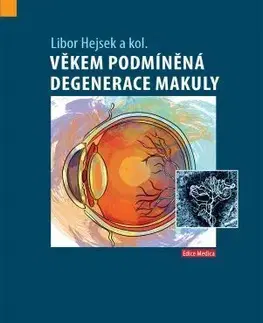 Medicína - ostatné Věkem podmíněná degenerace makuly - Libor Hejsek,Kolektív autorov