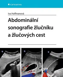 Medicína - ostatné Abdominální sonografie žlučníku a žlučových cest - Iva Hoffmanová