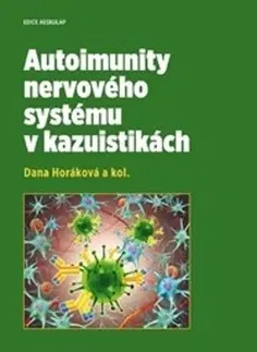 Medicína - ostatné Autoimunity nervového systému v kazuistikách - Dana Horakova