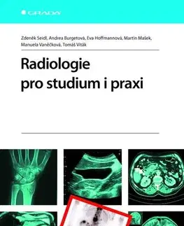 Medicína - ostatné Radiologie pro studium i praxi - Zdeněk Seidl,Kolektív autorov