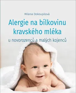 Alergológia, imunológia Alergie na bílkoviny kravského mléka u novorozenců a malých kojenců - Milena Dokoupilova