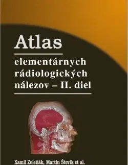 Medicína - ostatné Atlas elementárnych rádiologických nálezov - II. diel - Kamil Zeleňák