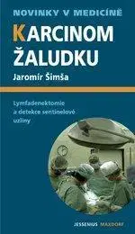 Medicína - ostatné Karcinom žaludku - Jaromír Šimša