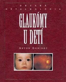 Medicína - ostatné Glaukómy u detí - Anton Gerinec