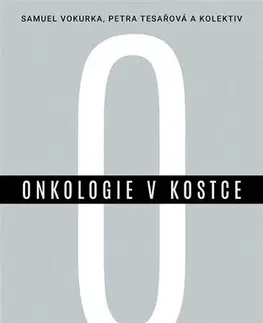 Onkológia Onkologie v kostce - Kolektív autorov,Samuel Vokurka