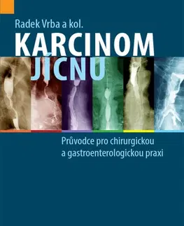 Chirurgia, ortopédia, traumatológia Karcinom jícnu - Radek Vrba,Kolektív autorov