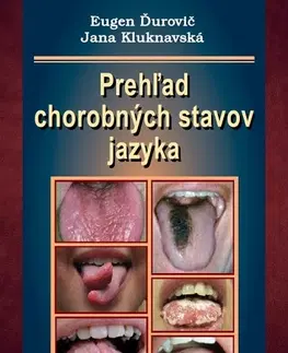 Medicína - ostatné Prehľad chorobných stavov jazyka - Eugen Ďurovič,Jana Kluknavská