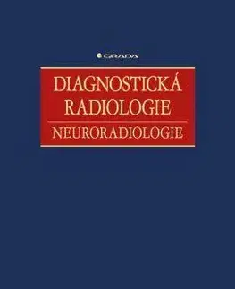 Medicína - ostatné Diagnostická radiologie - Zdeněk Seidl,Manuela Vaněčková