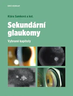 Medicína - ostatné Sekundární glaukomy - Kolektív autorov