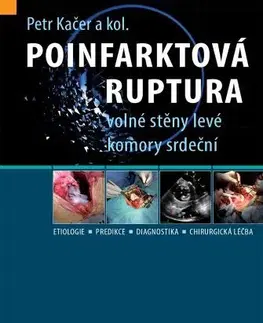Medicína - ostatné Poinfarktová ruptura volné stěny levé komory srdeční - Petr Kačer