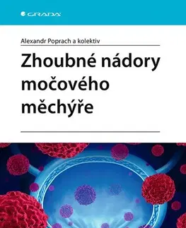 Onkológia Zhoubné nádory močového měchýře - Alexandr Poprach,Kolektív autorov