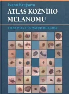 Medicína - ostatné Atlas kožního melanomu - Ivana Krajsová