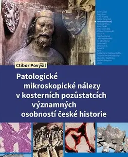 Odborná a náučná literatúra - ostatné Patologické mikroskopické nálezy v kosterních pozůstatcích významných osobností české historie - Ctibor Povýšil