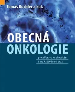 Onkológia Obecná onkologie - Tomáš Büchler,Kolektív autorov